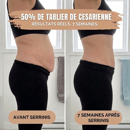 Serrinis Post-Partum — Compression 360°