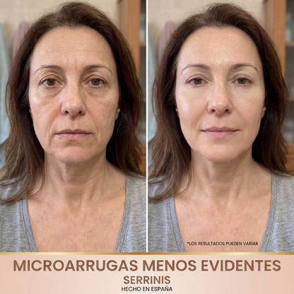 Serrinis – Sérum Coreano con Efecto Lifting desde la Primera Aplicación